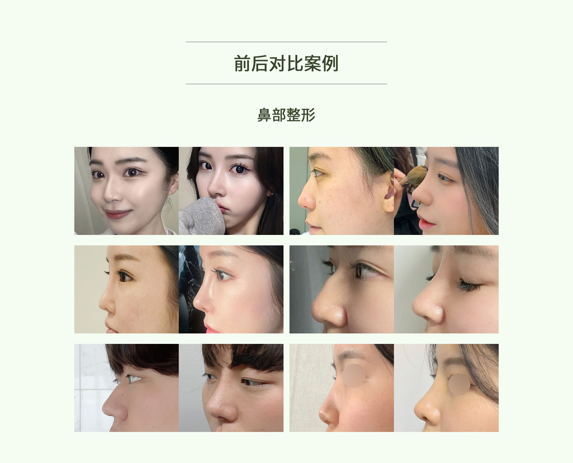 手术前/手术后
