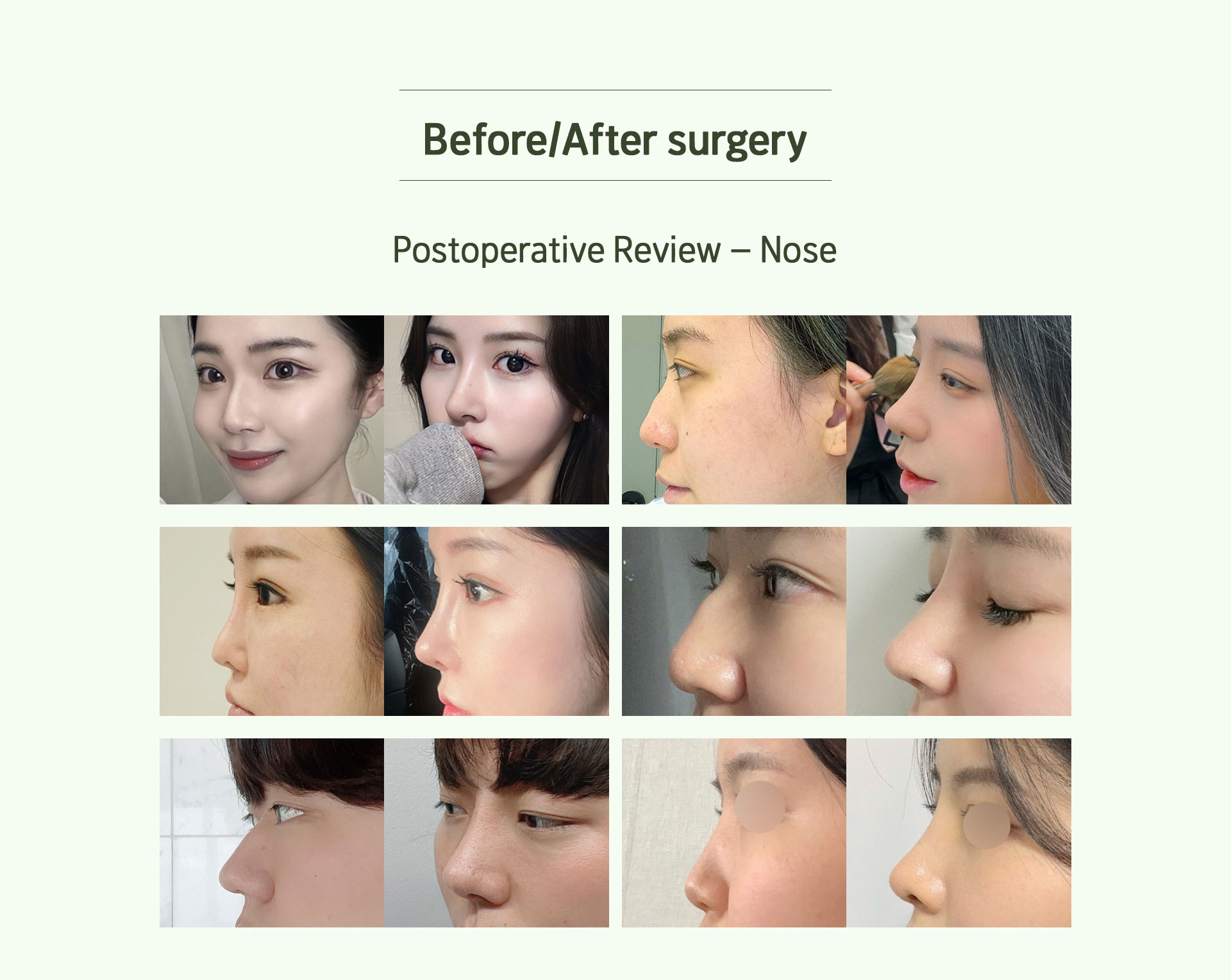 Postoperative Review – Nose