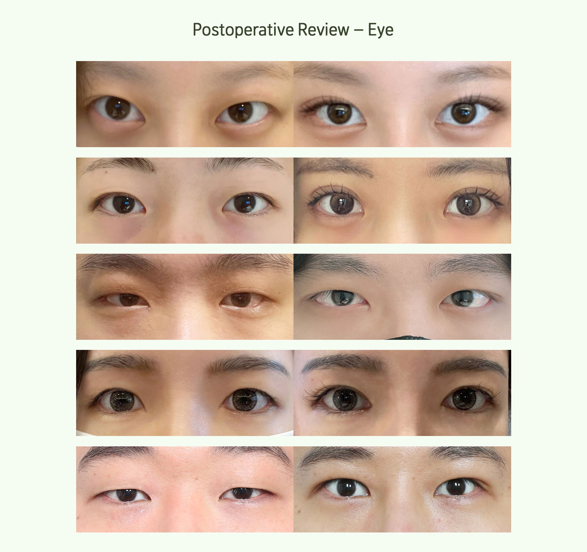 Postoperative Review – Eye